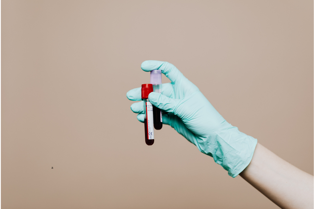 What Labs Really Matter in Hormone Therapy — and Which Ones Don’t